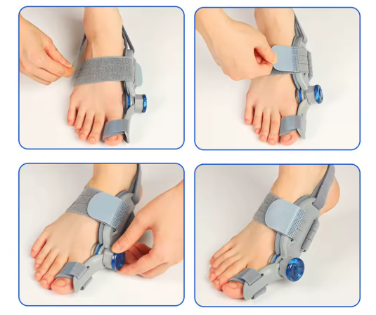 Bunion corrector